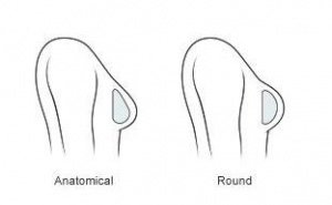 breast implant shape