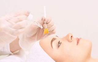 acne facial