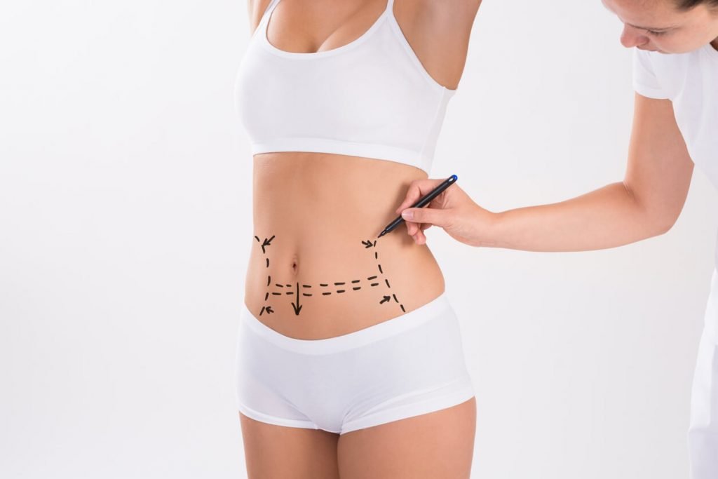 What is the Difference Between a Tummy Tuck and Liposuction?, Philadelphia Tummy  Tuck and Liposuction