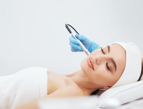 What Are the Top Benefits Of Facial Microdermabrasion?