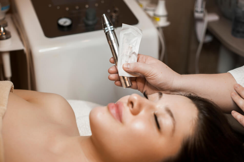 Candidates for Microneedling