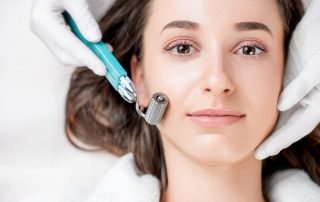 Does Microneedling for Acne Scars Work