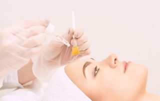 What's the Best Chemical Peel for Acne Scars and Large Pores