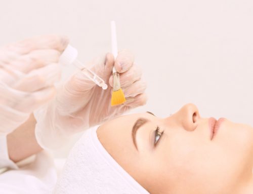 What’s the Best Chemical Peel for Acne Scars and Large Pores?