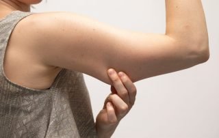 A Woman Pinching the Loose and Saggy Muscles in the Upper Arm