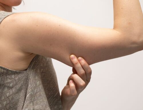 Thinking About Arm Lift Surgery? Things You Should Know