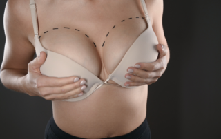 Breast Augmentation - Achieve Your Perfect Look | Dr. Semone Rochlin
