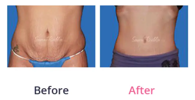 Before and After Expectations