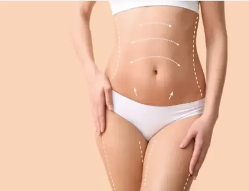 What is a Full Body Lift? Here’s Everything You Need to Know