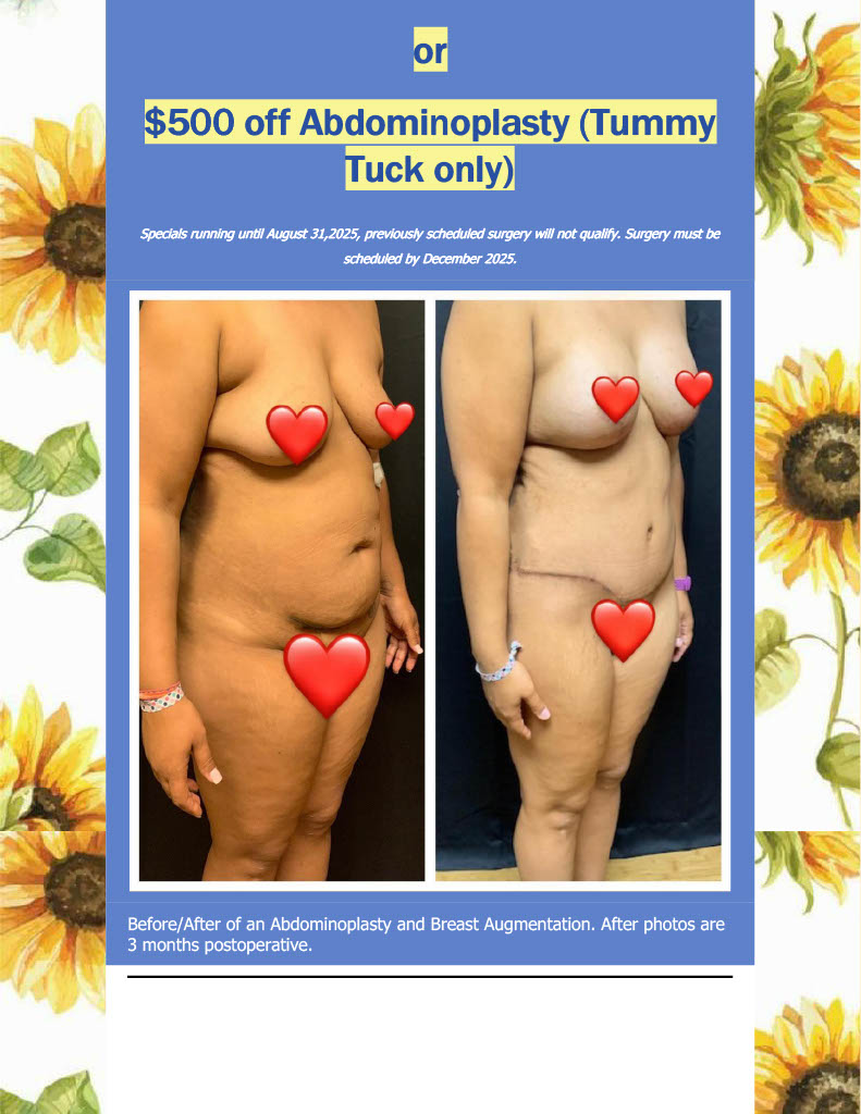 RHA & Daxxify Specials!